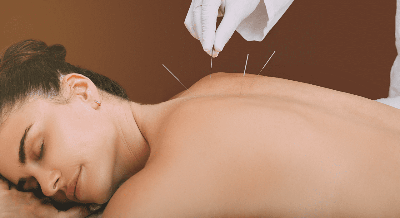 Les bienfaits de l'acupuncture